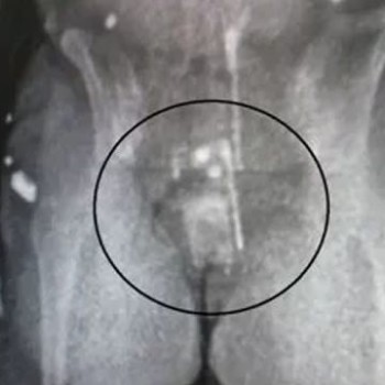Mulher tenta entrar com celular na vagina em presídio e é presa