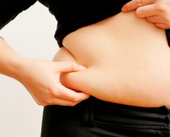 Obesidade abdominal gera mais risco de AVC isquêmico em mulheres, diz estudo