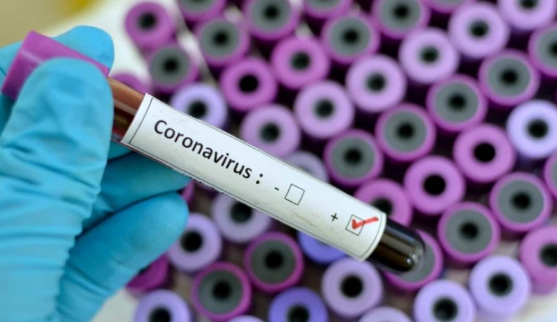 Itagimirim volta a registrar casos ativos de coronavírus
