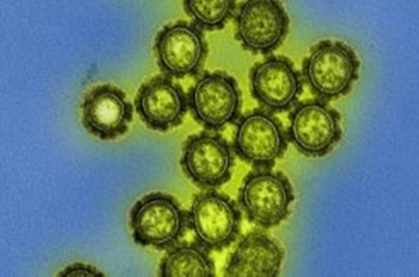 Entenda a gripe H3N2 que tem provocado surto em cidades do extremo Sul da Bahia