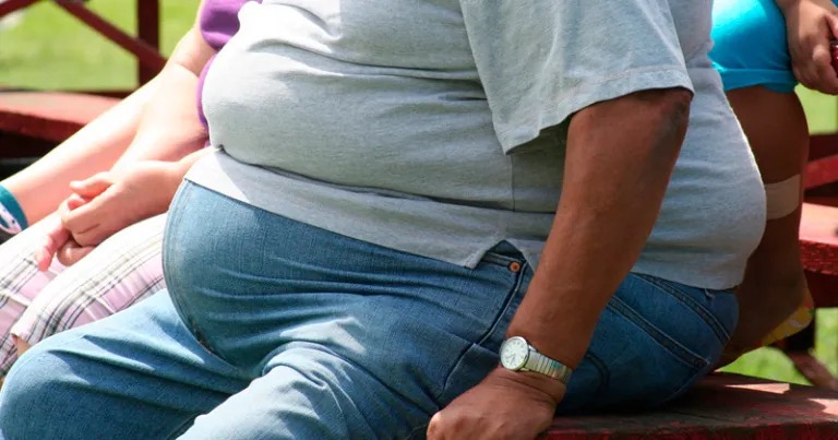 Entenda como pessoas com obesidade podem receber benefício previdenciário