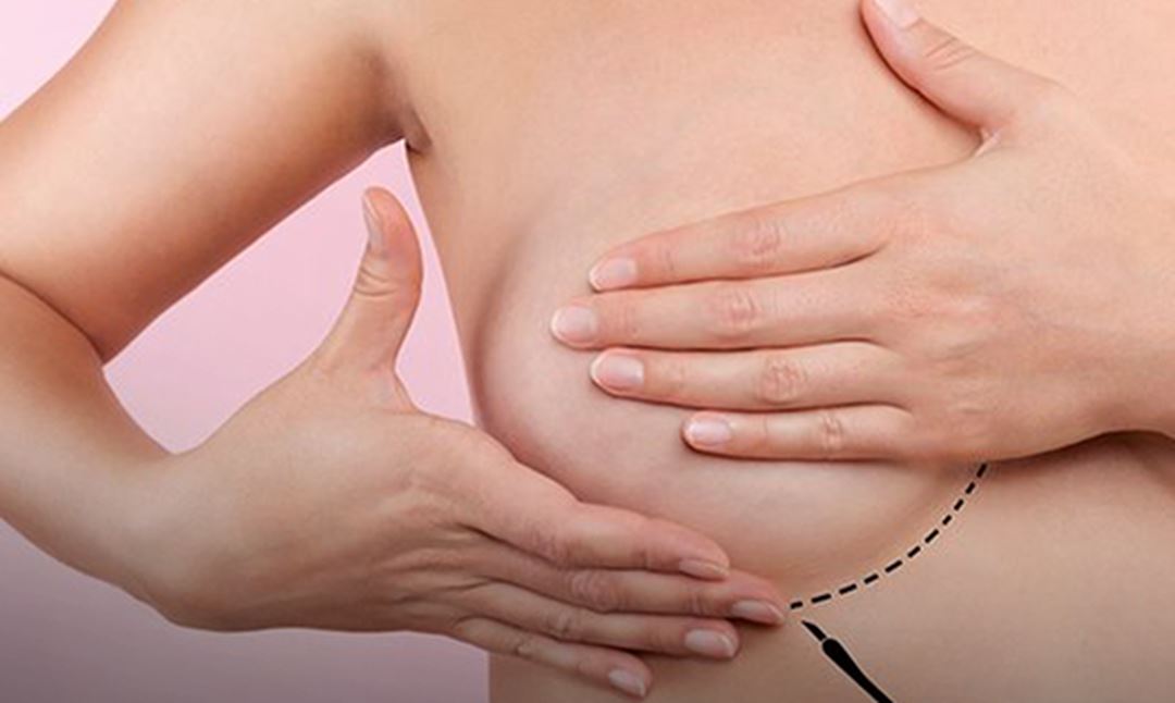 Outubro Rosa: mulheres com câncer de mama tem direito a benefícios do INSS